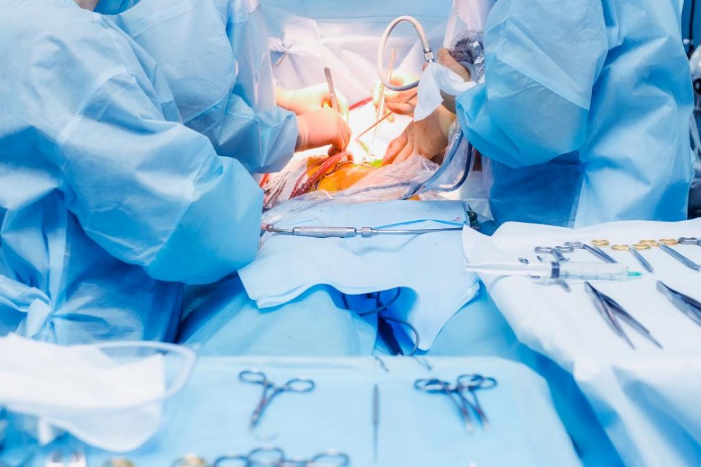 Tips to Prepare For Laparoscopic Surgery